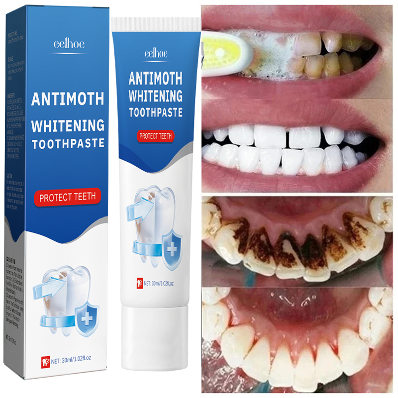 Teeth Whitening Fast - Schnelle Entfernung von Rauchflecken, Zahnpasta, Entfernung