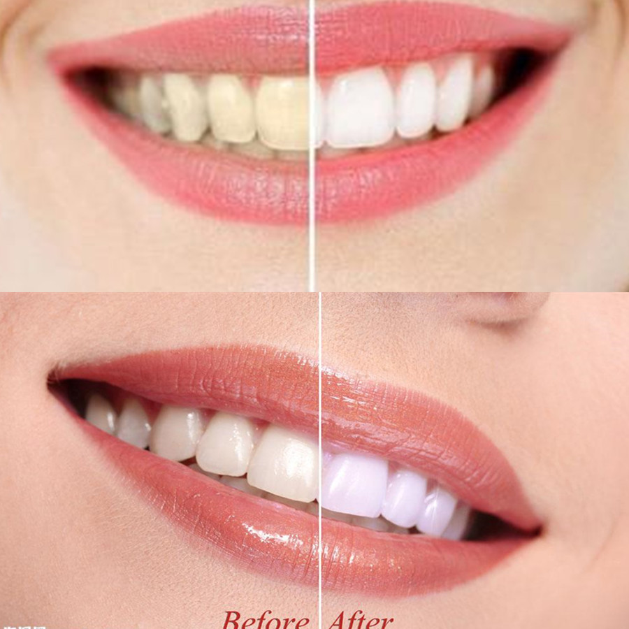 Bambus Holzkohle Zähne Zahn De – Teeth Whitening Zimba Bewertung und Preis
