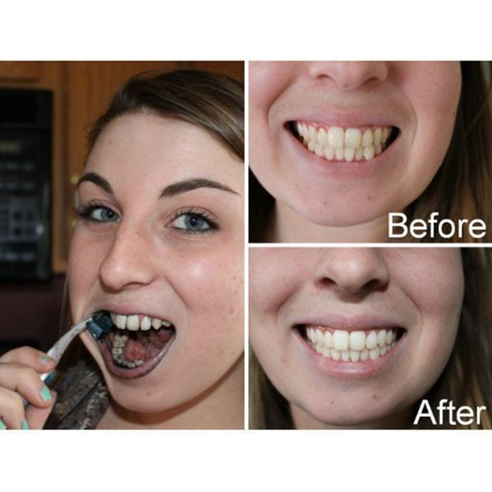 Bambus Holzkohle Zähne Zahn De – Teeth Whitening Zimba Bewertung und Preis