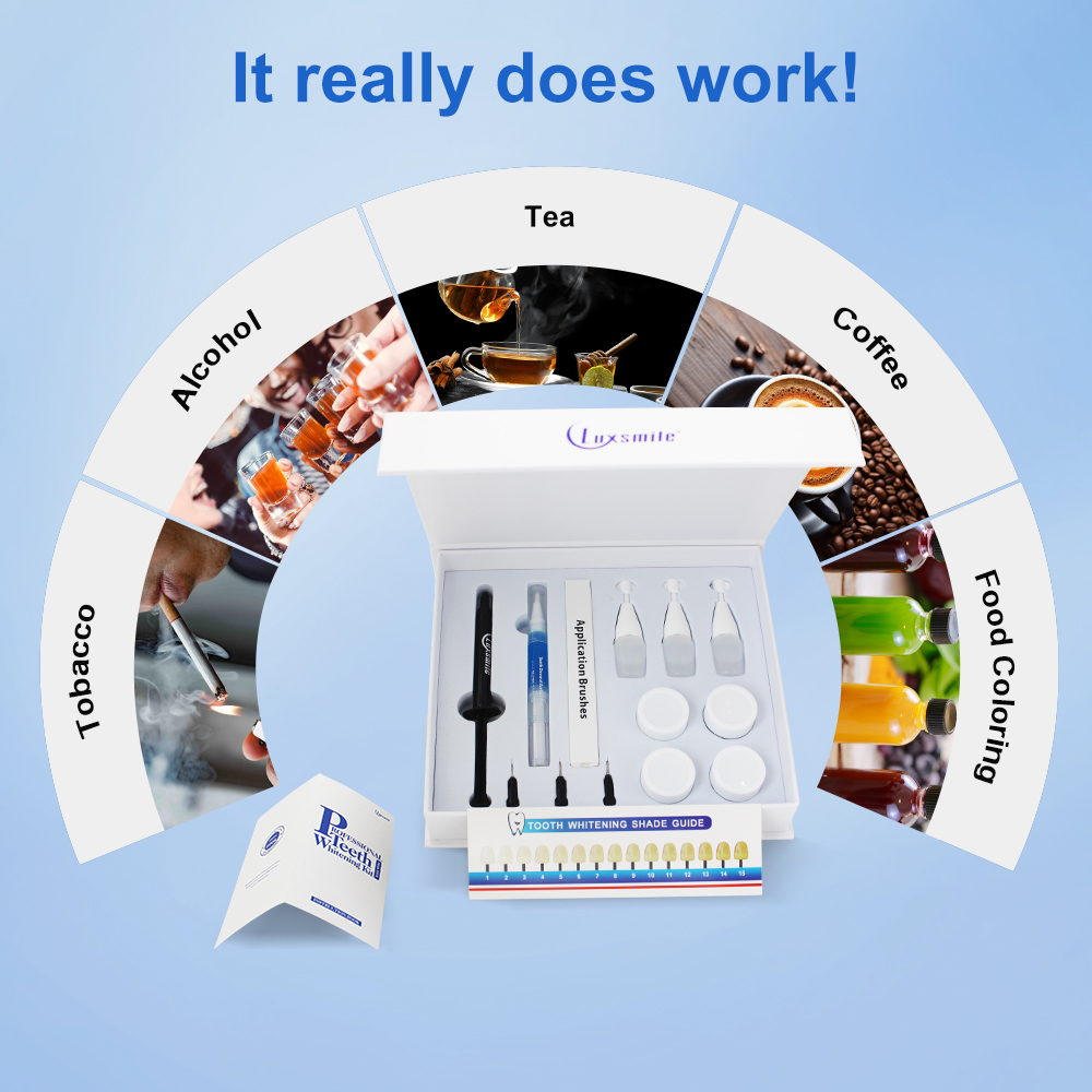 Zahnaufhellungsset, profession – Teeth Whitening Opalescence Bewertung und Preis