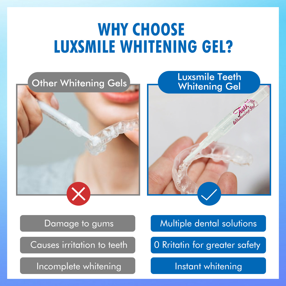 Zahnaufhellungs-Gel PAP oder 3 – Teeth Whitening Opalescence Bewertung und Preis
