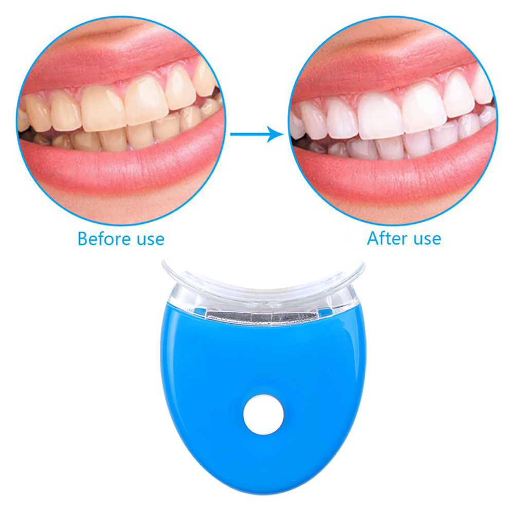 Zahnaufhellungsgel-Set, Mundhy – Teeth Whitening Opalescence Bewertung und Preis