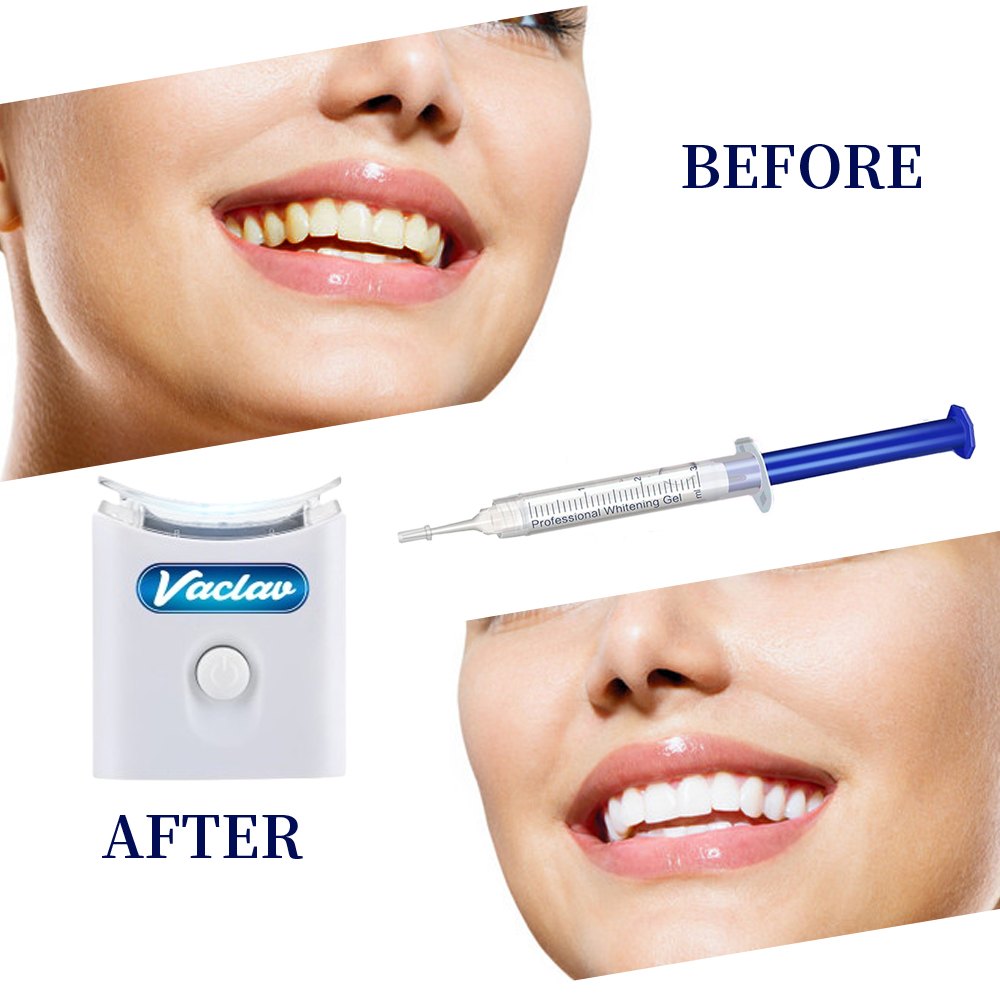 Minze Zähne Bleaching Gel Spri – Teeth Whitening Opalescence Bewertung und Preis