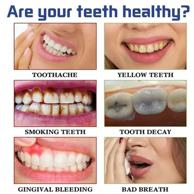 Schnelle Entfernung von Rauchf – Teeth Whitening Fast Bewertung und Preis