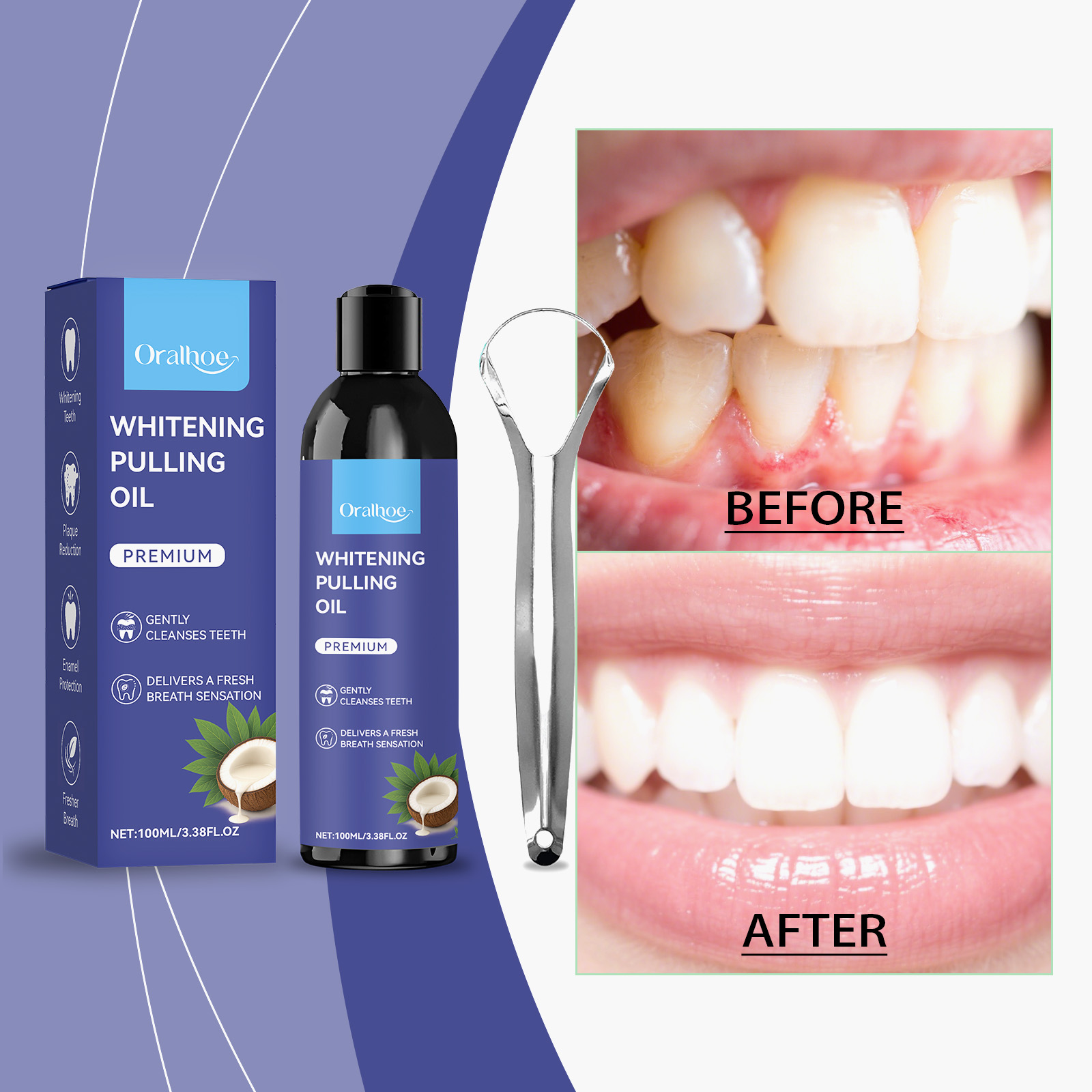 Pfefferminz-Kokosöl-Mundwasser – Teeth Whitening With Coconut Oil Bewertung und Preis