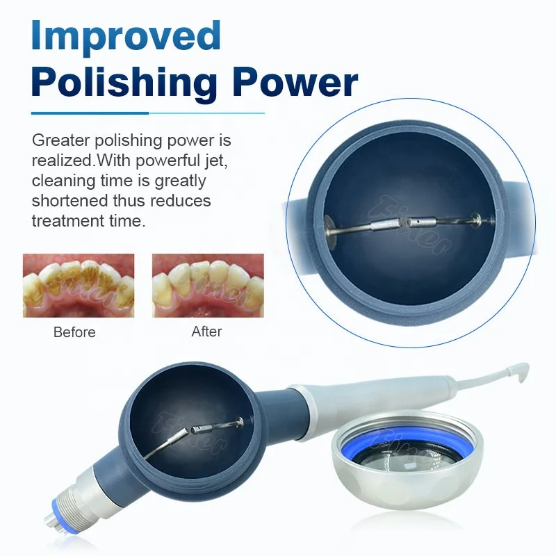 Prophy Mate Zahnreinigung, Auf – Teeth Whitening Fast Bewertung und Preis