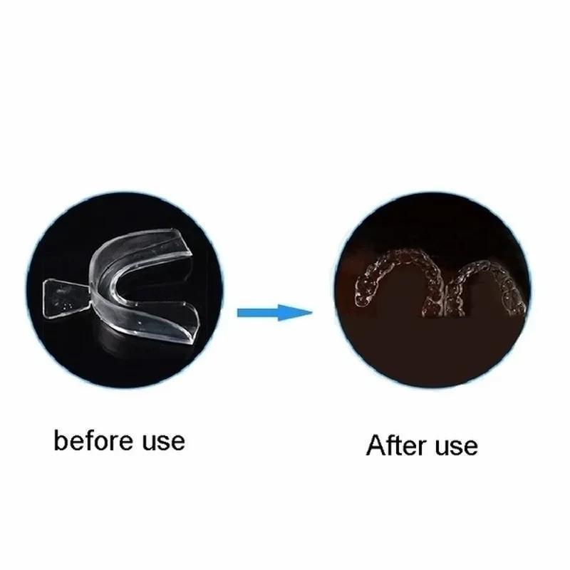 Professionelles Zahnaufhellung – Teeth Whitening Opalescence Bewertung und Preis