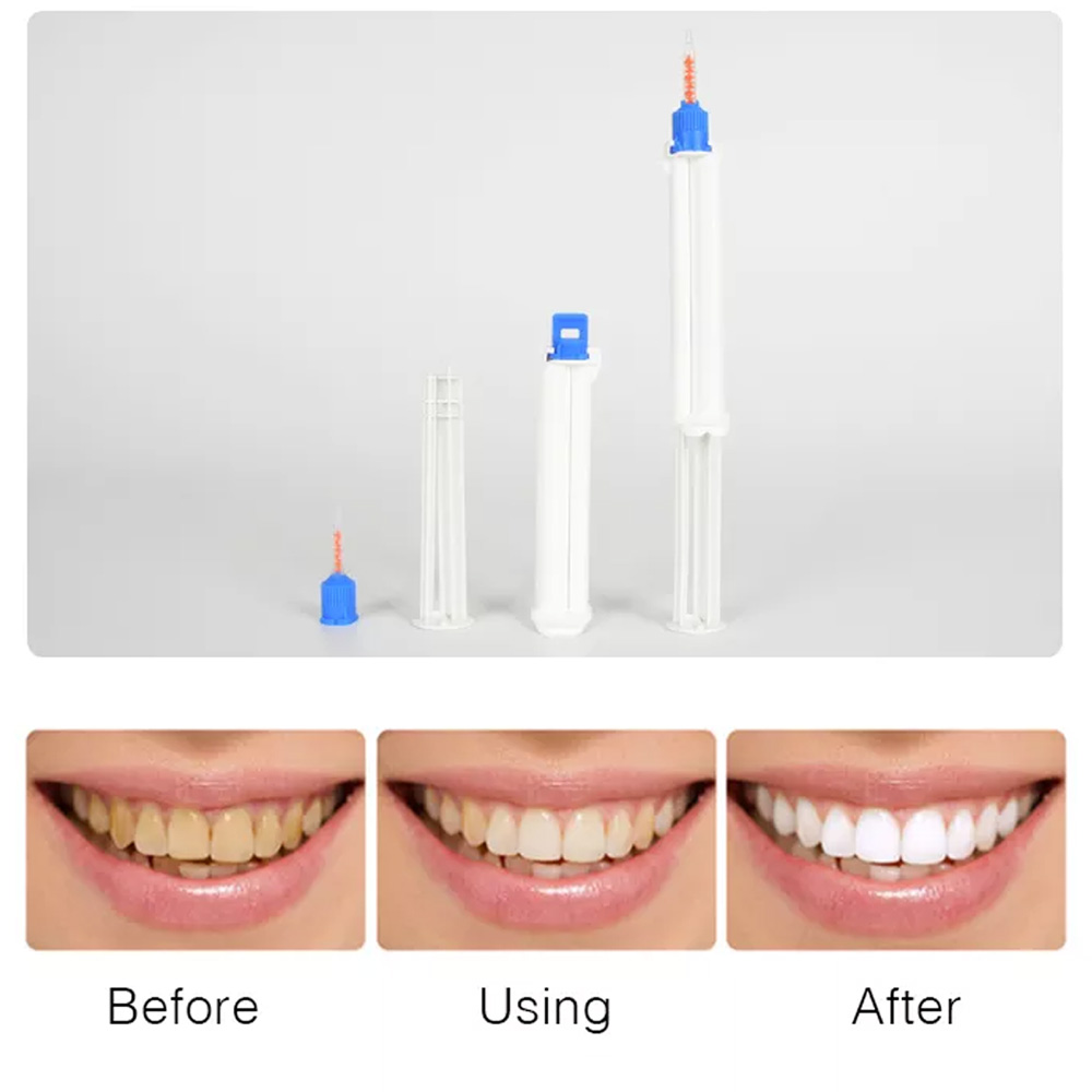 10/5/2 stücke Dental Dual Barr – Teeth Whitening Opalescence Bewertung und Preis