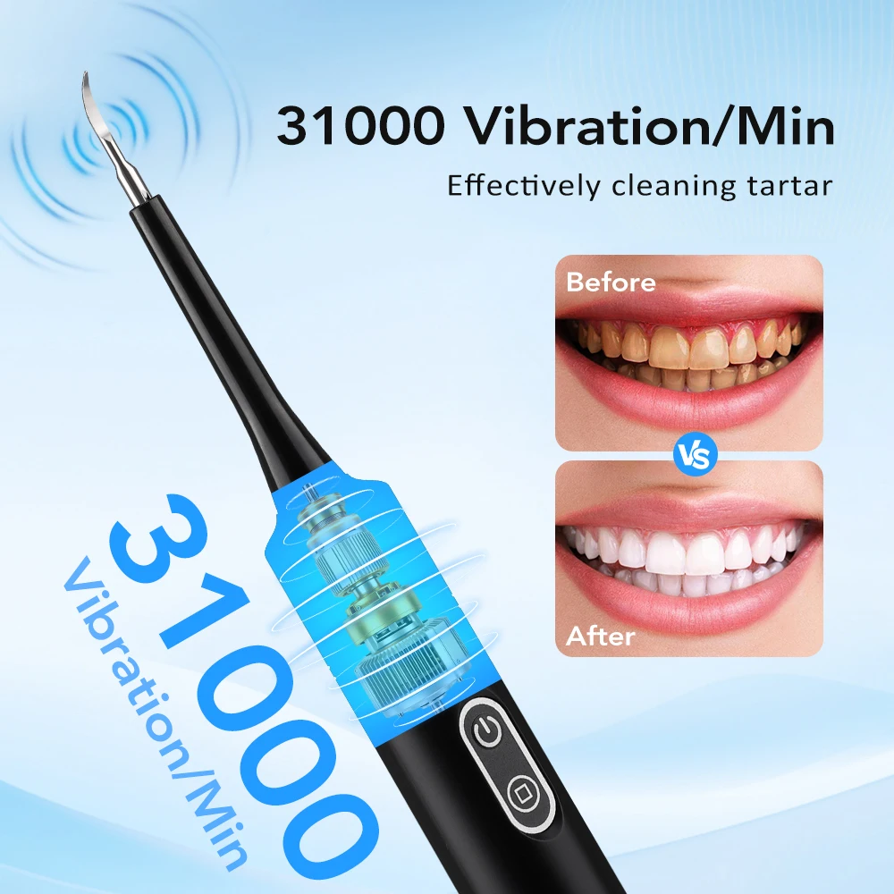 Elektrischer Schallvibrations- – Teeth Whitening Professional Bewertung und Preis